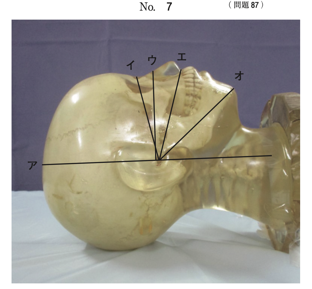 問87の頭部撮影基準線の図（出典：厚生労働省）